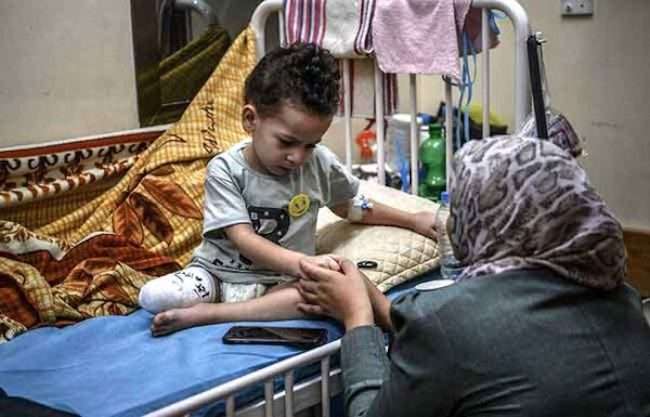 Gaza niño amputado Unicef